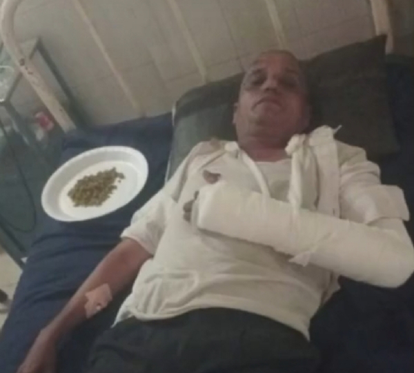 સાંતલપુરમાં સરપંચની ચૂંટણીની અદાવતમાં લોખંડની પાઇપ અને લાકડીઓથી હુમલો, બે ગંભીર ઈજાગ્રસ્ત સાંતલપુરમાં સરપંચની ચૂંટણીની અદાવતમાં લોખંડની પાઇપ અને લાકડીઓથી હુમલો, બે ગંભીર ઈજાગ્રસ્ત