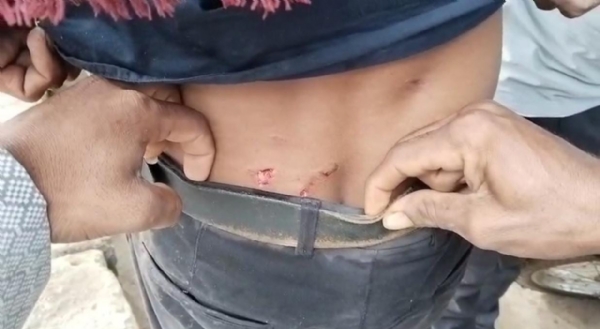 અમરેલી ગીદરડી ગામમાં માલધારી પર સિંહણનો હુમલો, યુવક ઇજાગ્રસ્ત અમરેલી ગીદરડી ગામમાં માલધારી પર સિંહણનો હુમલો, યુવક ઇજાગ્રસ્ત