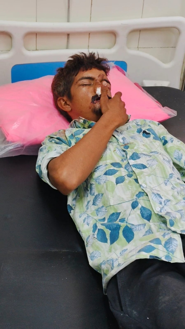 ચૌટા નજીક બાઇક સ્લીપ થતા બે યુવાનો ઇજાગ્રસ્ત