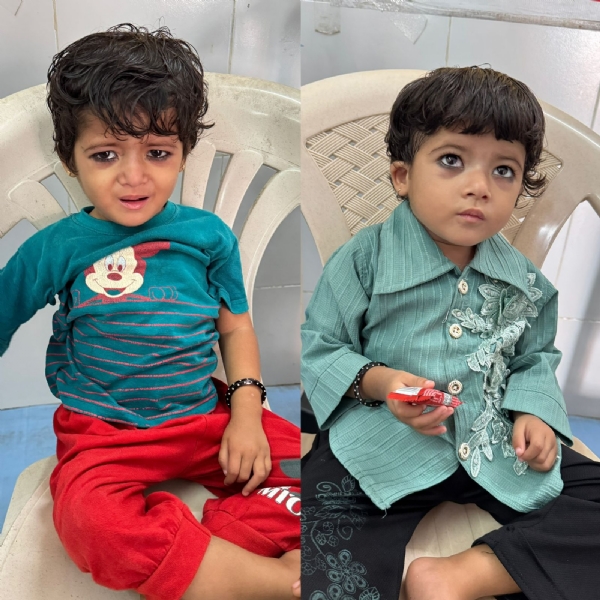 કૂપોષિત બાળકને