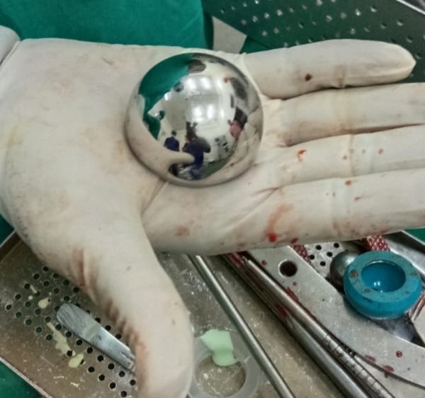 AMBAJI NI SARKARI HOSPITAL NI KAMGIRI