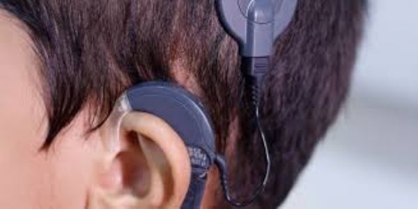 જન્મજાત બહેરા બાળકો માટે કોંકલીયર ઈમ્પ્લાન્ટ આશીર્વાદરૂપ: આરોગ્ય મંત્રી પ્રફુલ પાનસેરીયા