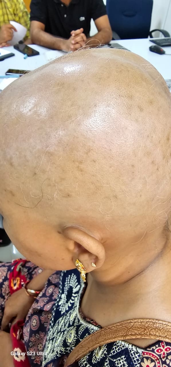 મહિલા મહિલા