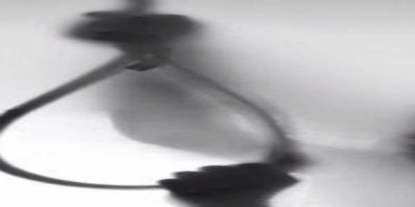 સુરતમાં 8 મહિનાના બાળક સામે માતાએ આપઘાત કર્યો