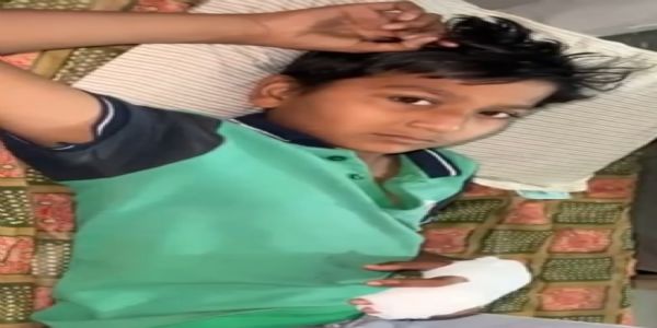 રાધનપુરની શાળામાં વિદ્યાર્થીની આંગળીમાં સળીયો ઘૂસ્યો, સારવાર મુદ્દે વિવાદ