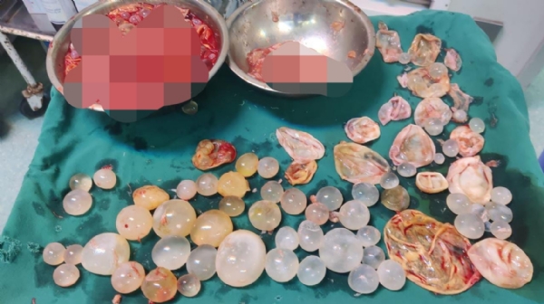 ડોટર સિસ્ટ