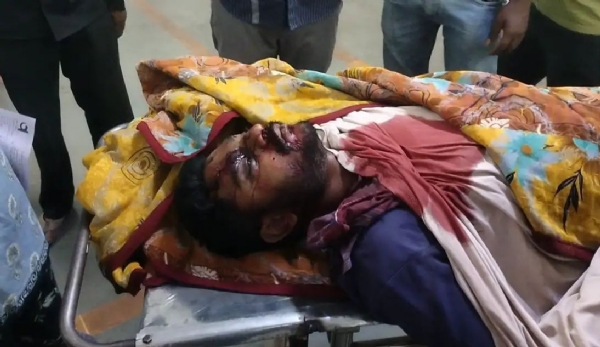 અમરેલી ગાવડકા રોડ પર ભીષણ અકસ્માત, બાઈક-રિક્ષા ટક્કરમાં એકનું મોત