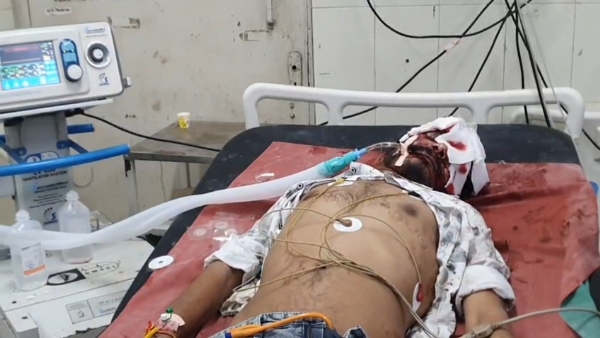 પોરબંદરના ઍરપોર્ટ નજીક બે બાઈક વચ્ચે અકસ્માતમાં ચાર યુવાનના મોત. પોરબંદરના ઍરપોર્ટ નજીક બે બાઈક વચ્ચે અકસ્માતમાં ચાર યુવાનના મોત.